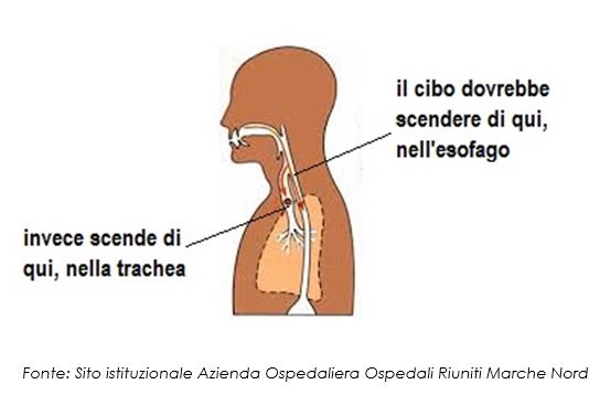 La disfagia