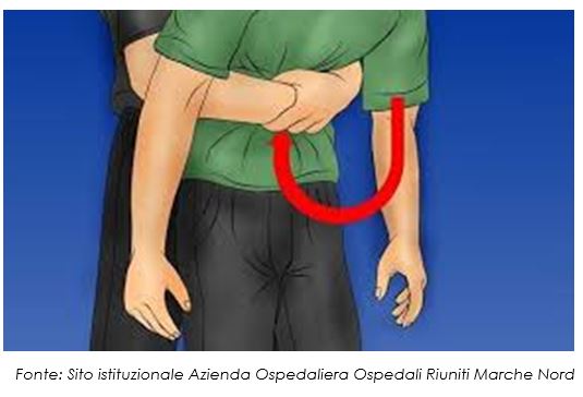 Manovra di Heimlich