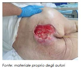 riduzione della lesione